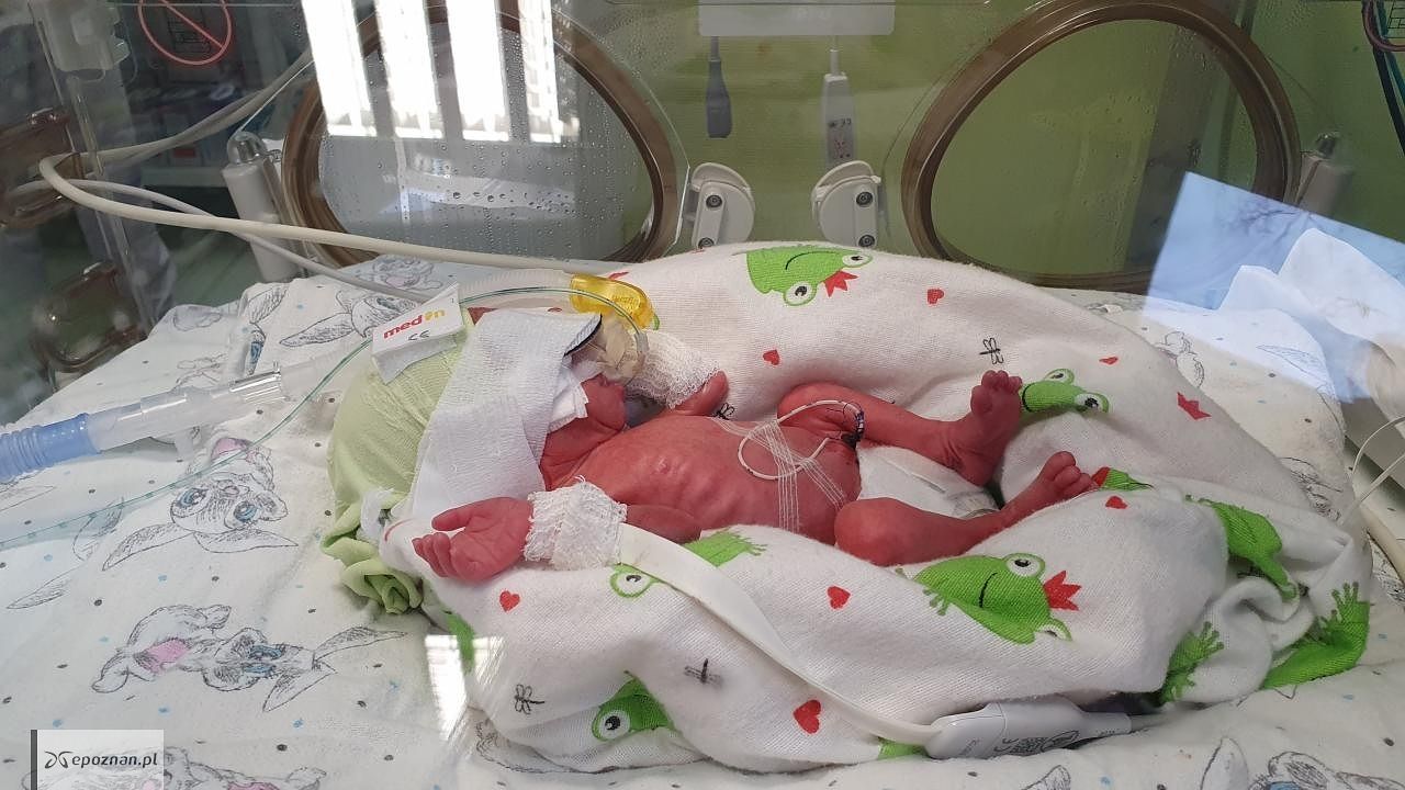 fot. GPSK przy ulicy Polnej